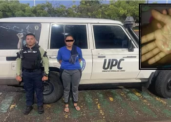 Madre desalmada quemaba las manos de sus hijos como forma de castigo (+Fotos)