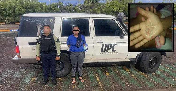Madre desalmada quemaba las manos de sus hijos como forma de castigo (+Fotos)