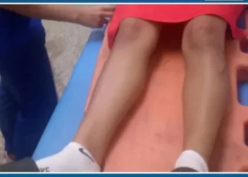 Adolescente lesionada tras derrape de motocicleta en San Carlos 